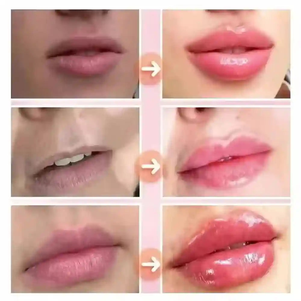 Lip Plumper Serum - Hydrating Anti-Wrinkle Treatment by Tidesmit Lip Care Tidesmit