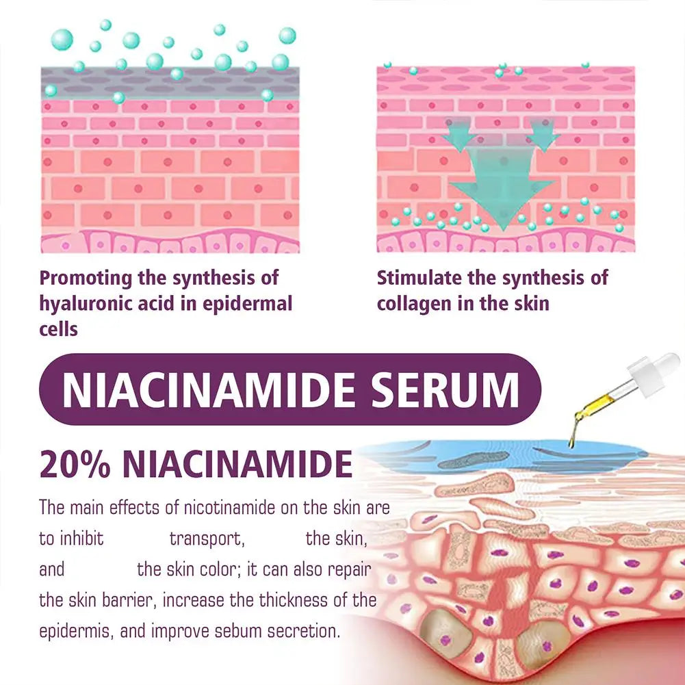 Niacinamide Serum 20% High Concentration Formula Serum Brightens Lightens Spots Niacinamide Care Serum Lifts Nasal Lines