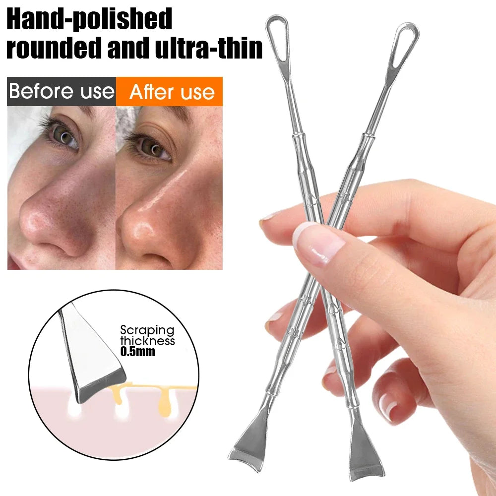 Blackhead Remover Tool Kit 4pc - Professional Stainless Steel Acne Set Scrubs Treatments Tidesmit