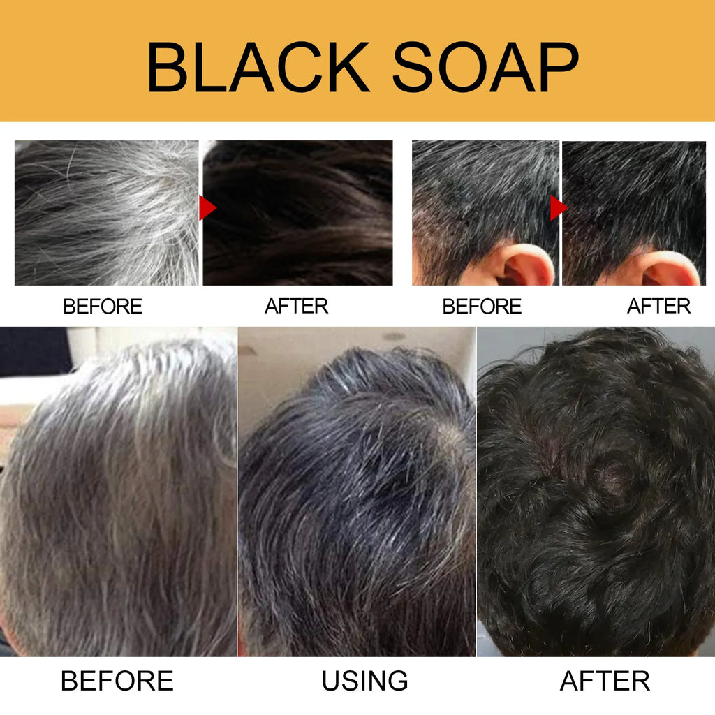 Grey Coverage Bar Shampoo Repair Gray White Hair Color Treatment Smoothing Nourishing Anti Dandruff Natural Hair Darkening Soap