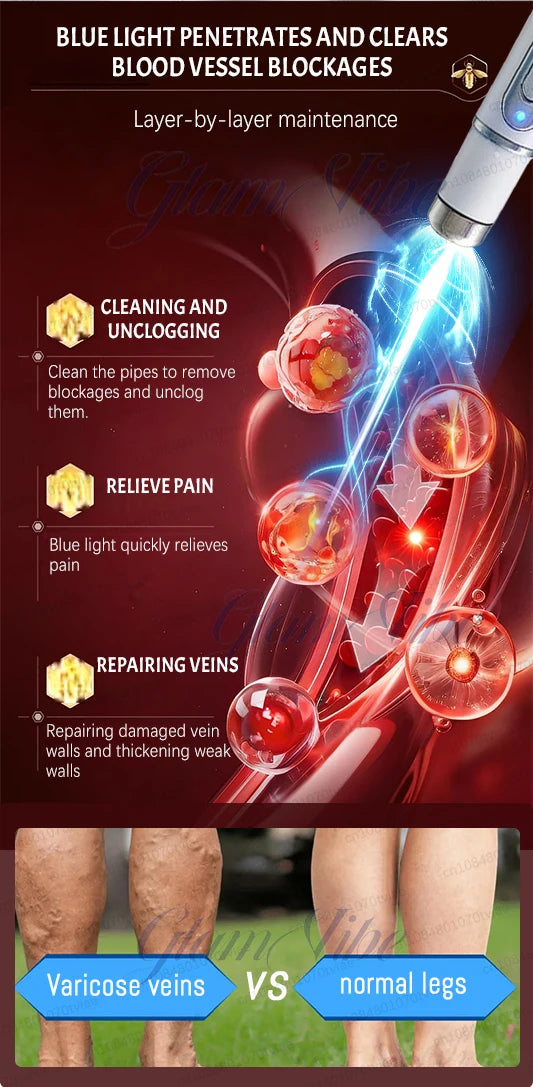 Blue light therapy pen with metallic tip, used to treat varicose veins and improve blood vessel health in legs.