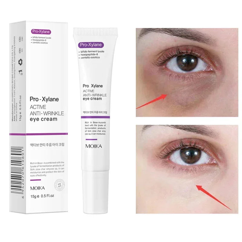 Pro-Xylane anti-wrinkle eye cream tube and box with before-and-after results for dark circles and puffiness.
