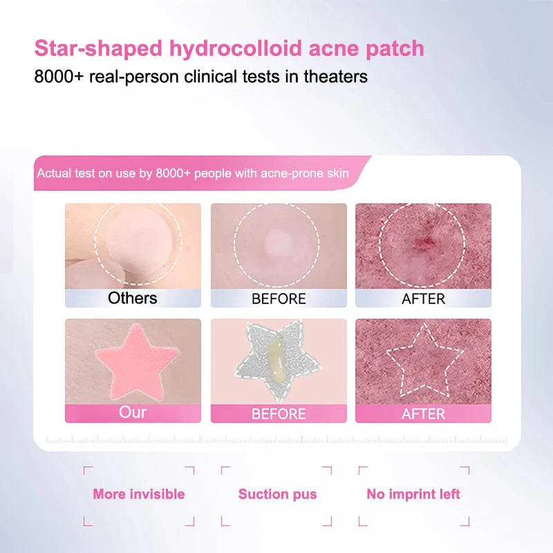 360Pcs Colorful Invisible Pimple Removal Anti-Acne Hydrocolloid Patches Spots Marks Concealer Beauty Makeup Tool Repair Sticker