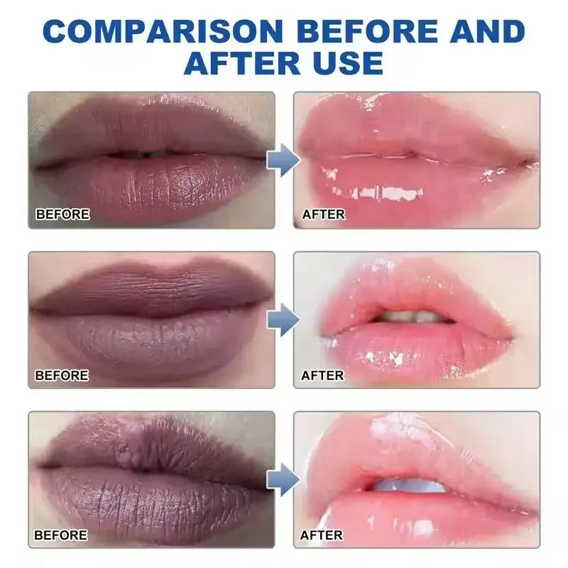 Dark Lip Lightening Balm – Exfoliating Lip Care Treatment by Tidesmit Lip Care Tidesmit