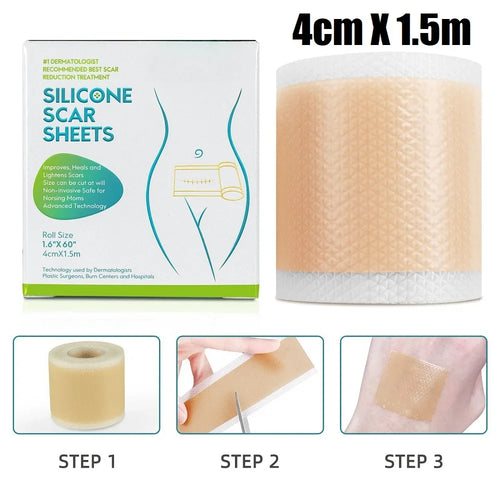 Silicone scar sheet roll, beige self-adhesive strip with white backing