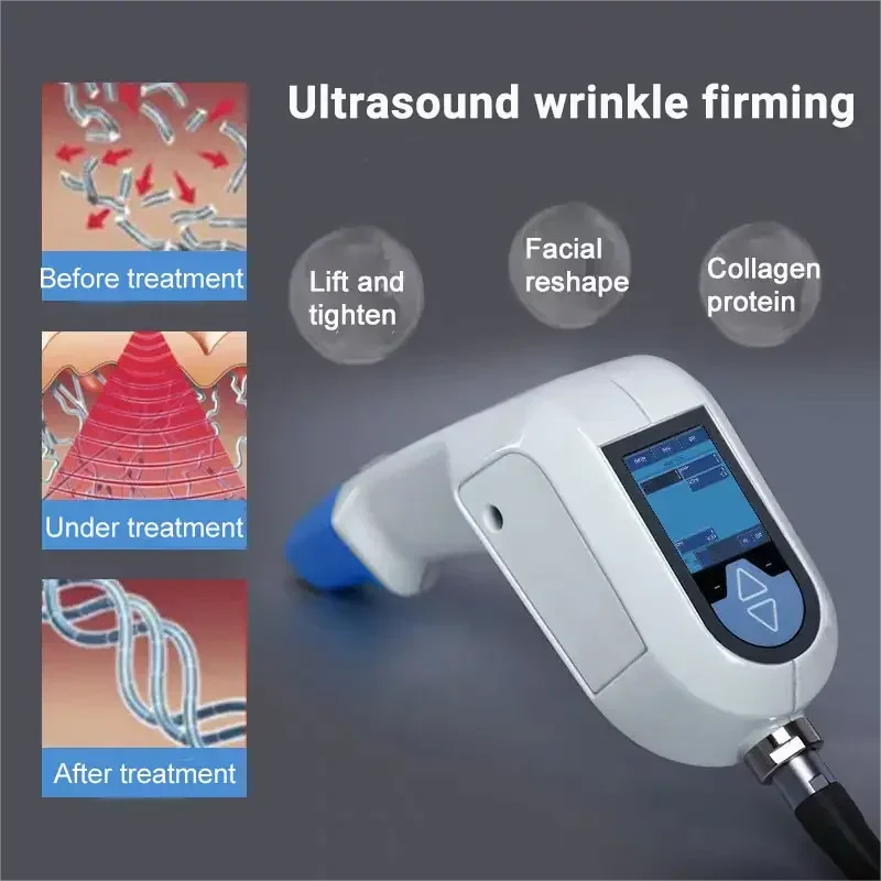 Professional Skin Tightening Machine for Face Lifting and Fat Removal Relaxation Treatment Tidesmit