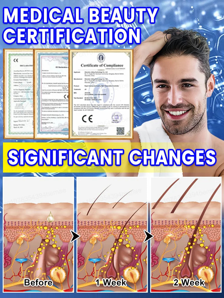 Hair Growth Serum | Follicle Health Support | Tidesmit 1 Pack Relaxation Treatment Tidesmit