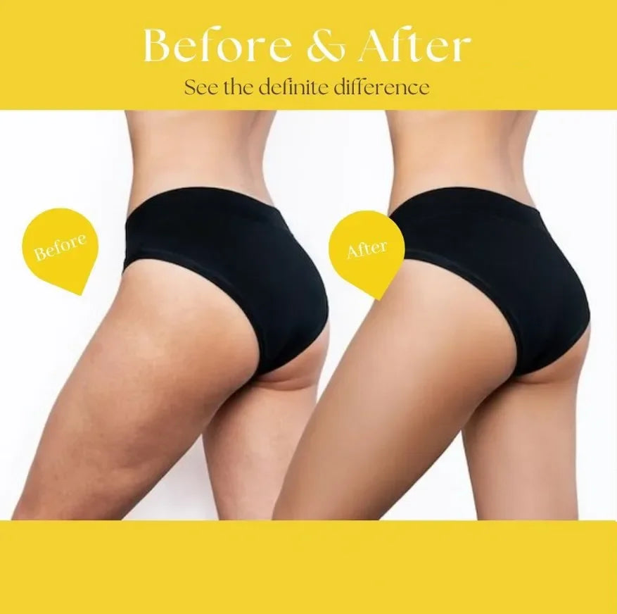 Before and after results of Lemon Ampoule Serum for body slimming, cellulite reduction, and skin tightening.