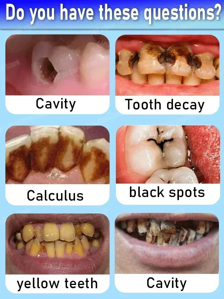 Tidesmit teeth whitening and cavity repair kit removing plaque and stains for healthy white teeth