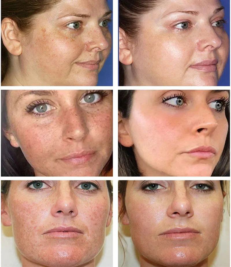 Dark Spot Corrector Cream for Pigmentation & PMU Aftercare | Tidesmit Permanent Makeup Machines Tidesmit