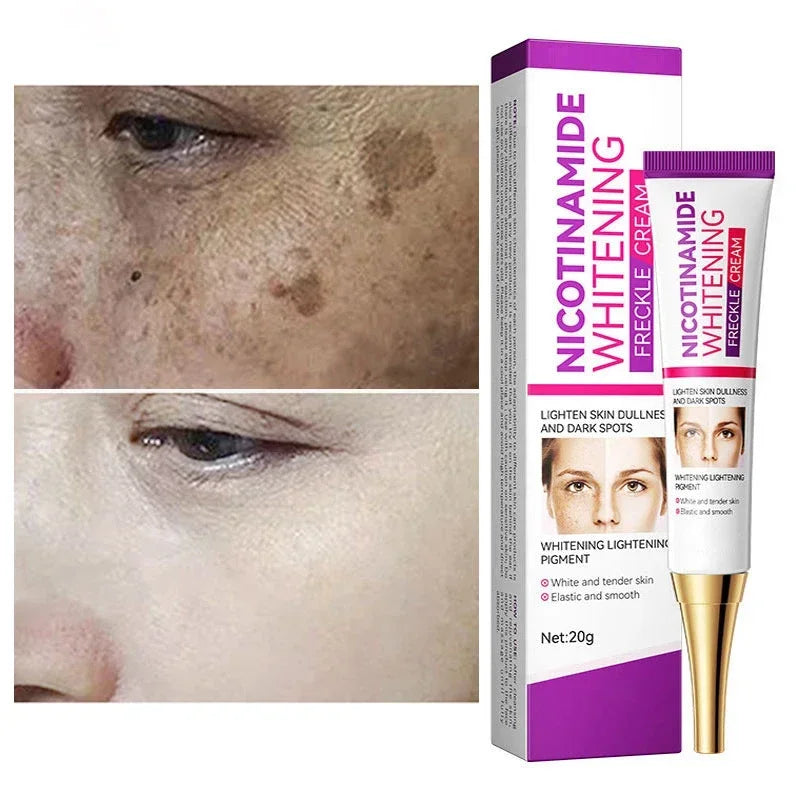 Tidesmit Niacinamide melasma cream texture close-up for fading dark spots and brightening uneven skin tone