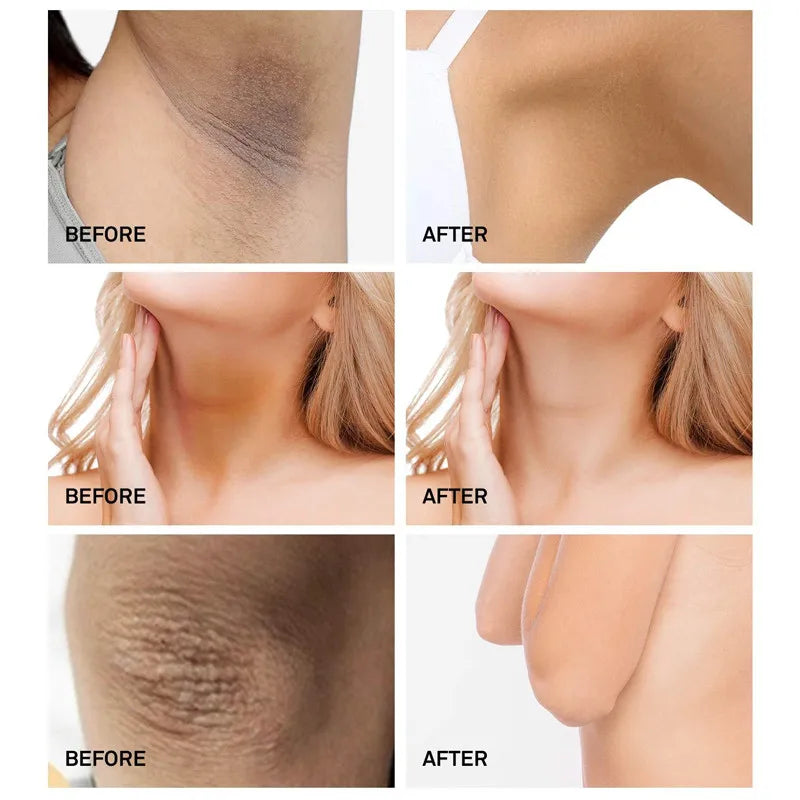 Body Whitening Niacinamide Brighten Cream For Intimate Parts Underarm Bleach Knees Lighten Thigh Inner Korean Skin Care Products