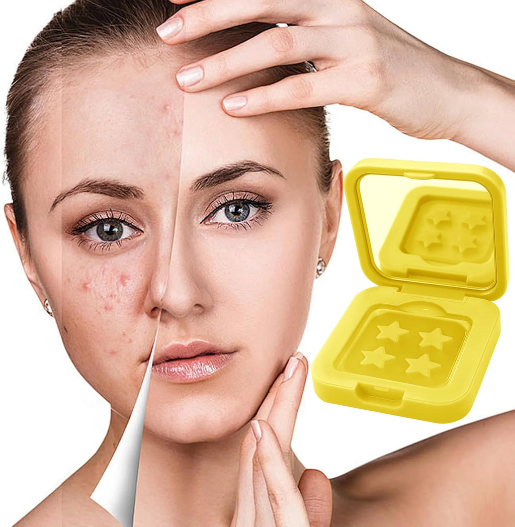 60 pieces/premium mirror acne patch, covering acne and pimple patches, deep cleansing patch, gentle and skin friendly