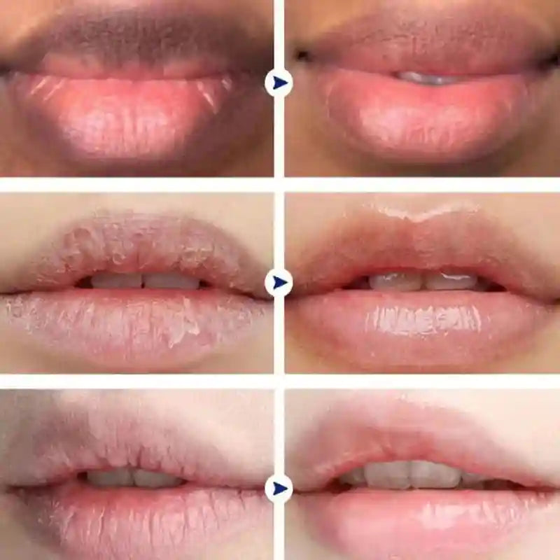 Pink Lip Lightening Serum for Dark Lips - Moisturizing Lip Care Lip Care Tidesmit