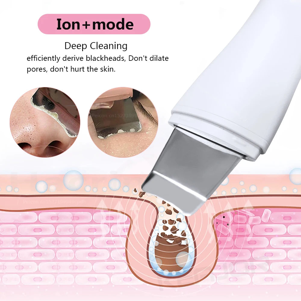 Ultrasonic Skin Scrubber Facial Cleanser - White Professional Care Scrubs Treatments Tidesmit