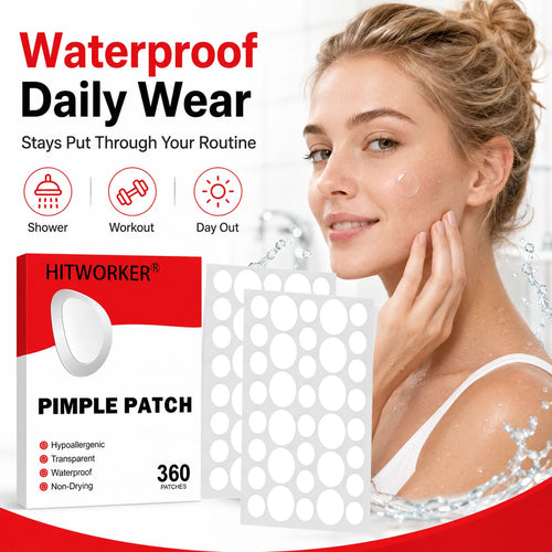 Facial pimple hydrocolloid patch set with clear round patches on skin, 360 count