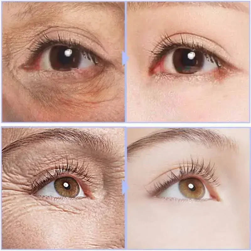 Anti Aging Eye Cream for Dark Circles & Puffiness - Tidesmit EU Scrubs Treatments Tidesmit