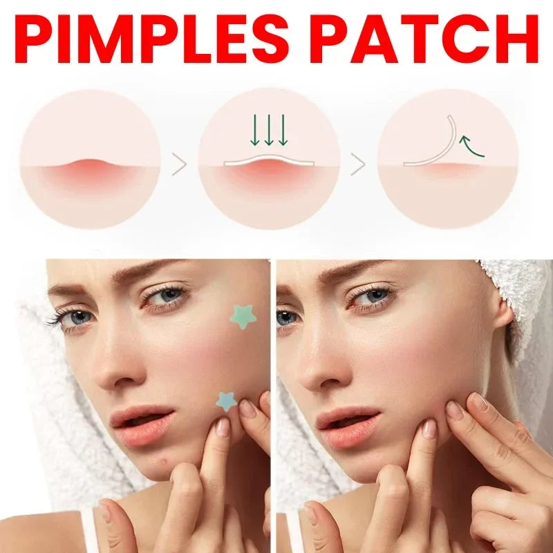 200/400pcs Acne Patches Invisible Pimple Cover for Face Oil Control Spot Treatment Cute Sticker for Covering Zits and Blemishes