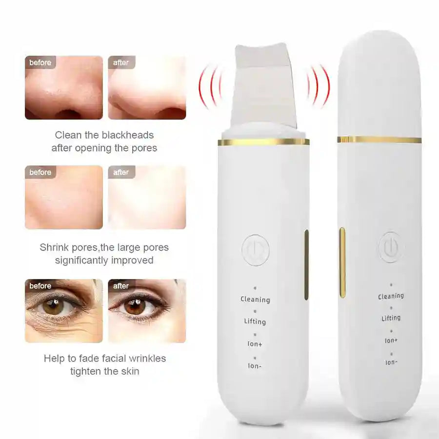 Ultrasonic Skin Scrubber - Professional Deep Pore Cleansing Facial Tool Scrubs Treatments Tidesmit