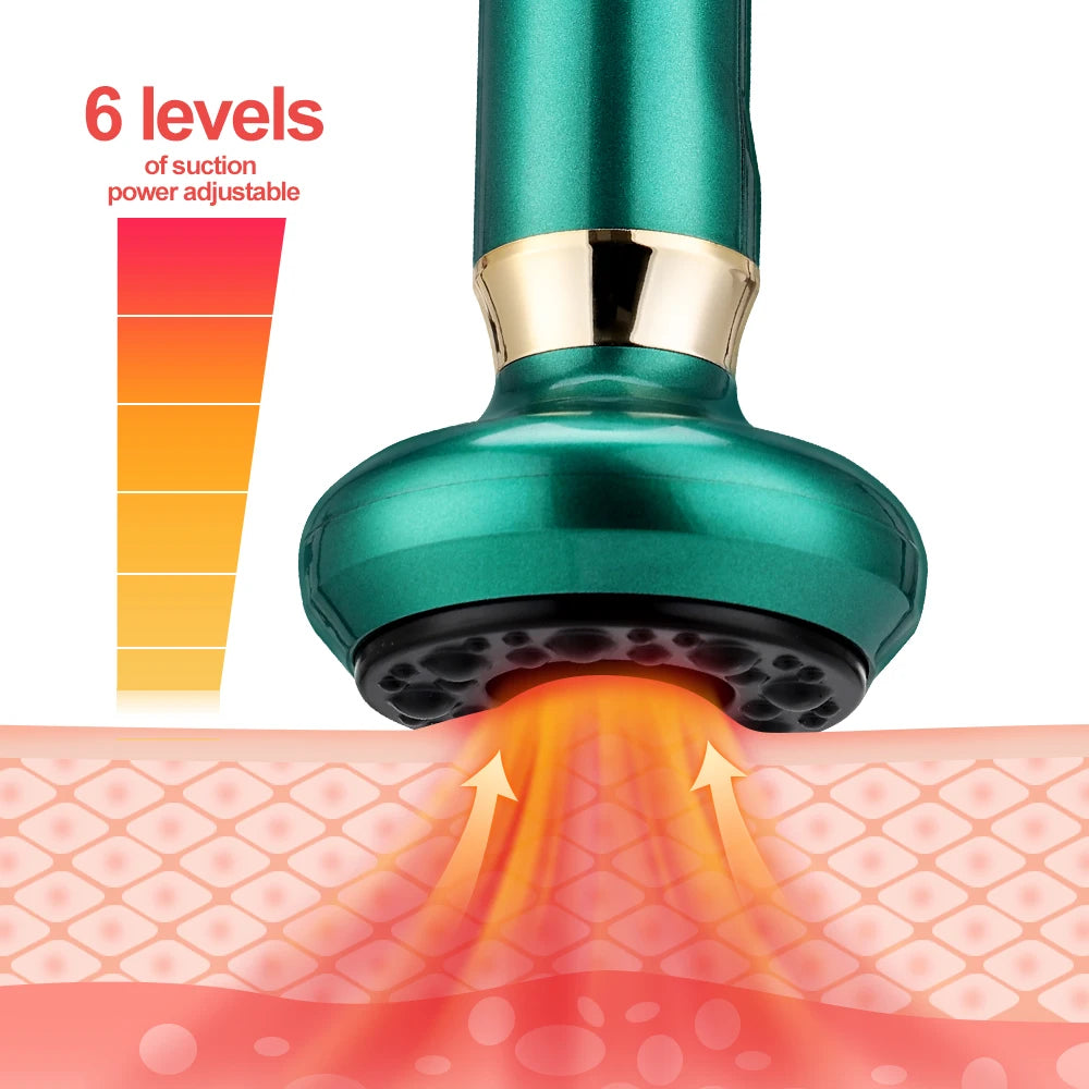 Green handheld electric cupping massager with gold trim and 6 adjustable suction levels for skin therapy.