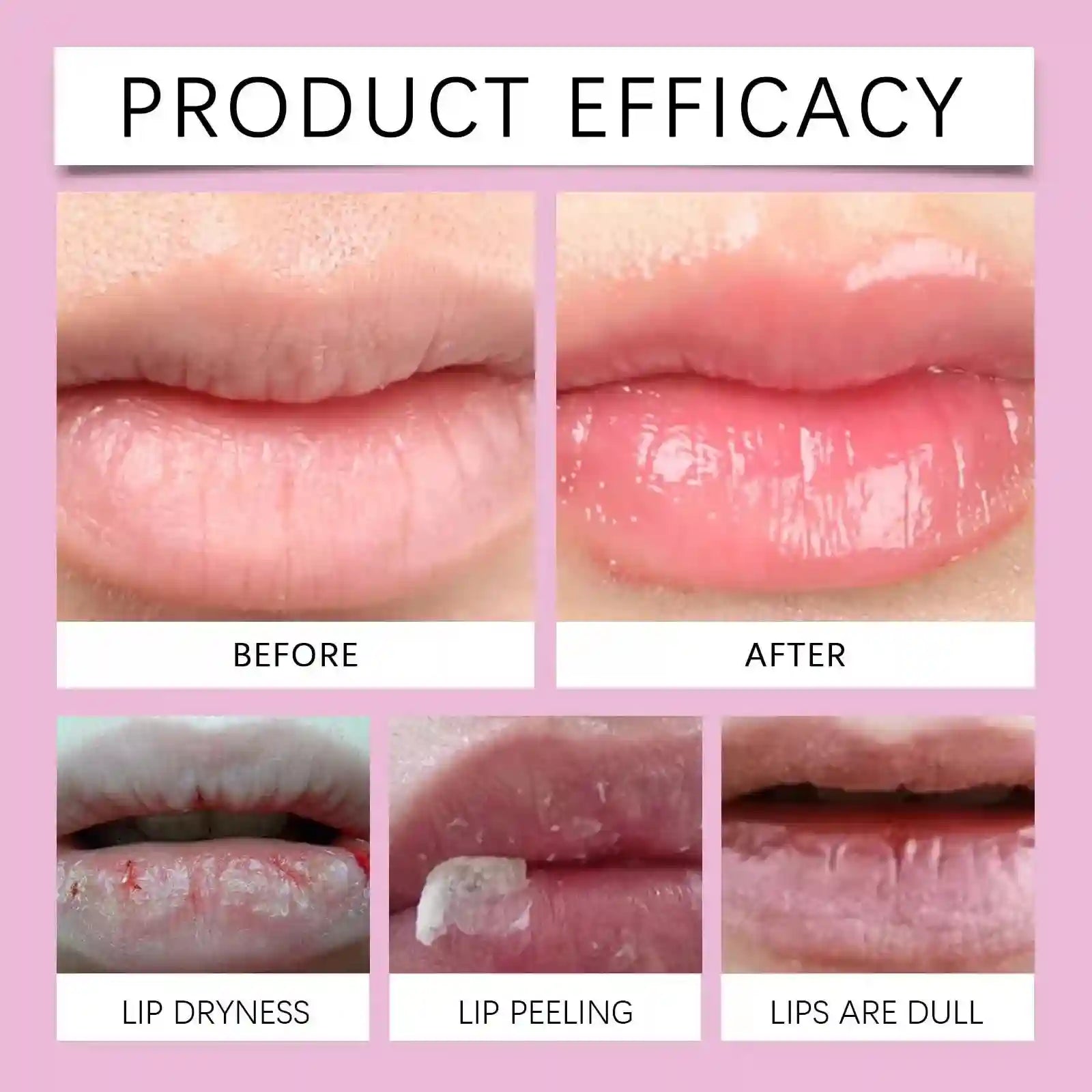 Lip Plumping Serum – Nourishing Anti-Wrinkle Lip Treatment Lip Care Tidesmit
