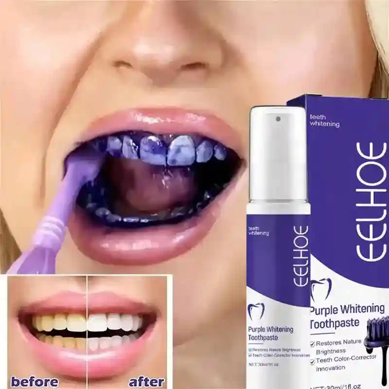 Tidesmit 2026 whitening toothpaste for effective yellow teeth removal and daily oral hygiene care