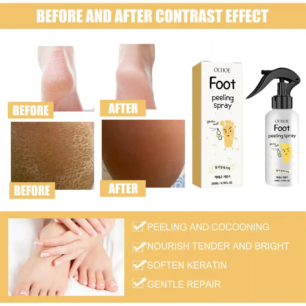 Foot Exfoliating Spray | Professional Callus Remover & Moisture Lock Scrubs Treatments Tidesmit
