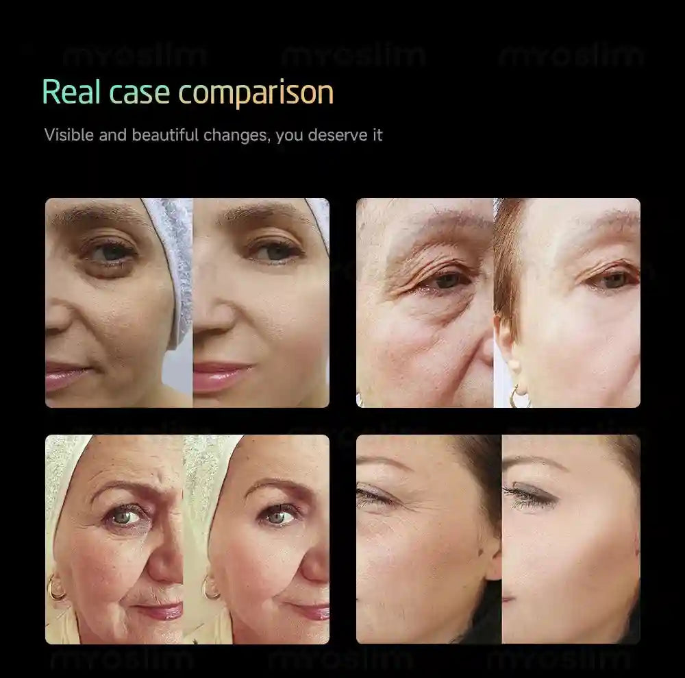 Professional Facial Tightening Machine | Skin Lifting & Firming Tool Eye Massage Instrument Tidesmit