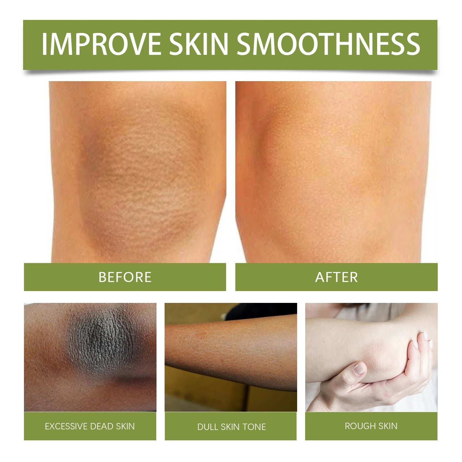 Fig Sugar Body Scrub Exfoliating Moisturizer - Natural Smoothing Care Scrubs Treatments Tidesmit