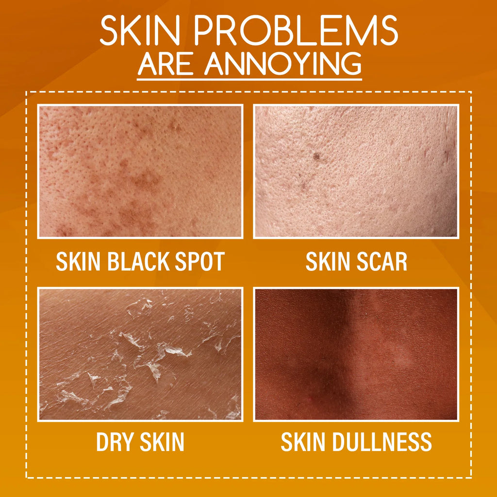 Orange Peeling Lotion for Dark Skin - Professional Exfoliating Formula 100ml Scrubs Treatments Tidesmit