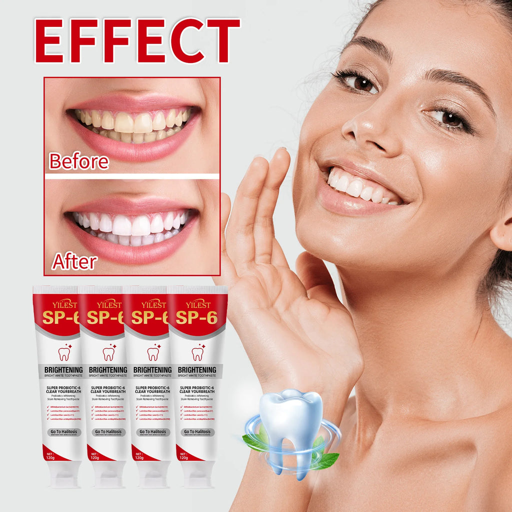 Tidesmit SP-6 Probiotic Whitening Toothpaste 120g for plaque removal, cavity prevention, and fresh breath.
