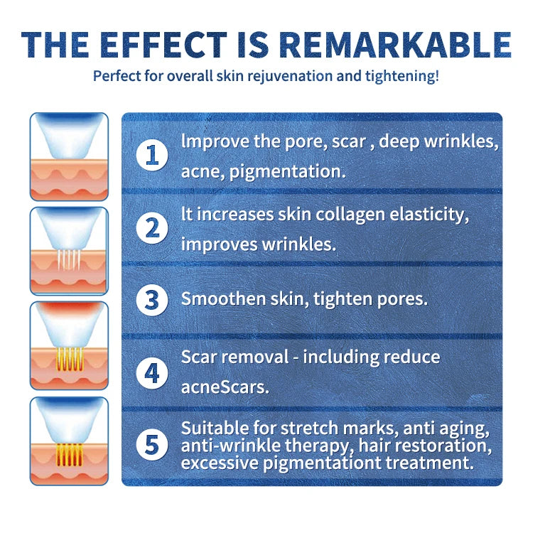 Portable fractional RF skin tightening device infographic for wrinkle, stretch mark, and acne scar removal treatment.