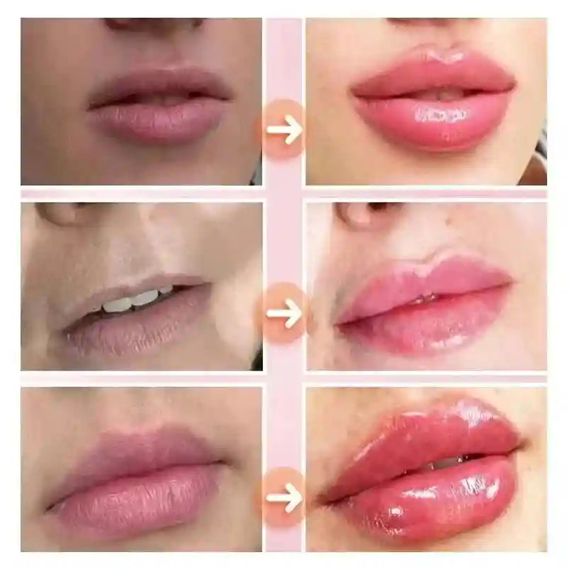 Lip Plumper Serum: Nourishing Lip Treatment for Full, Hydrated Lips Lip Care Tidesmit