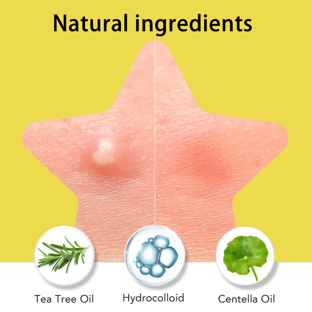 60 pieces/premium mirror acne patch, covering acne and pimple patches, deep cleansing patch, gentle and skin friendly