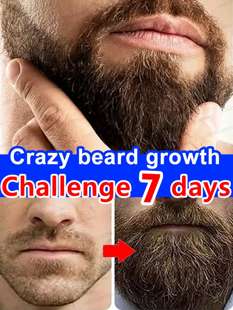 Beard Growth Essence for Thicker Facial Hair - Natural Formula Relaxation Treatment Tidesmit
