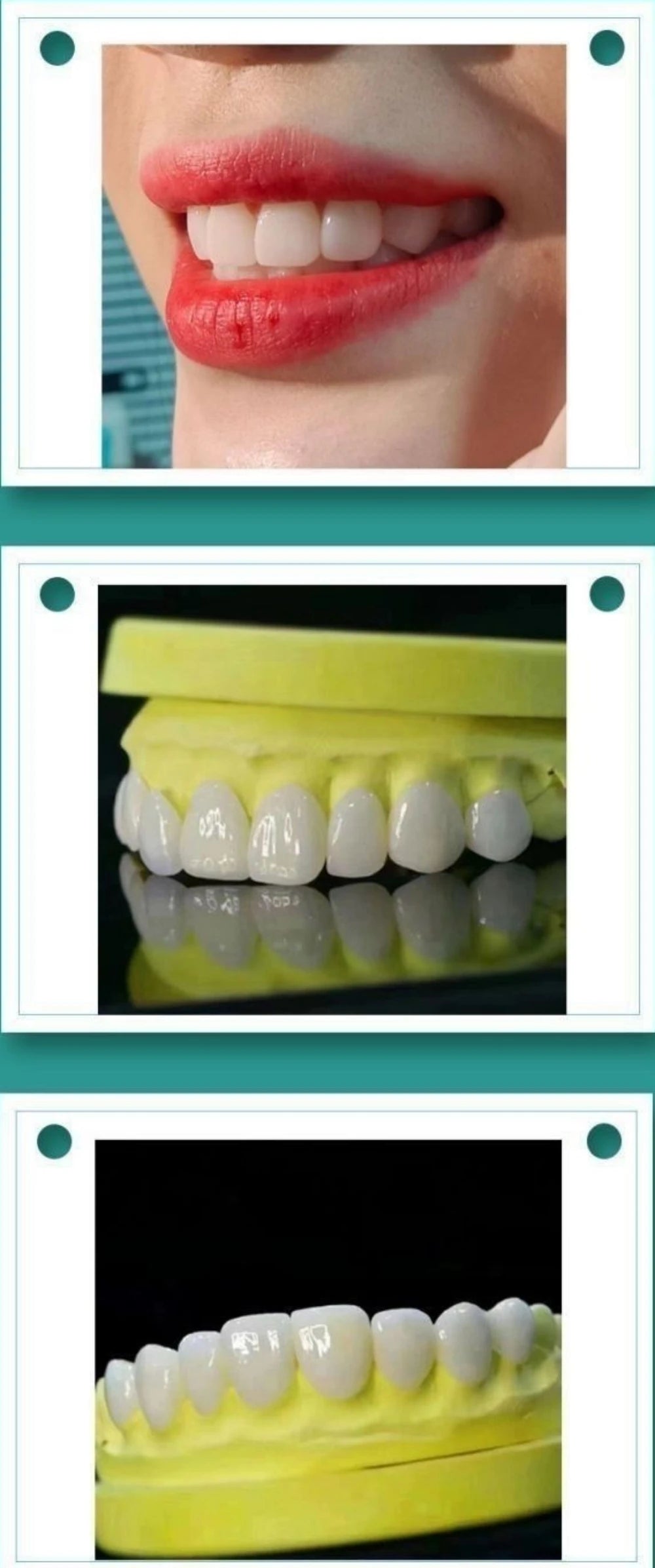 30PCS Lodden Lithium Disilicate C14 Dental Lab Glass-matrix Ceramics Block Chairside Restoration Aesthetics Materials Wholesale