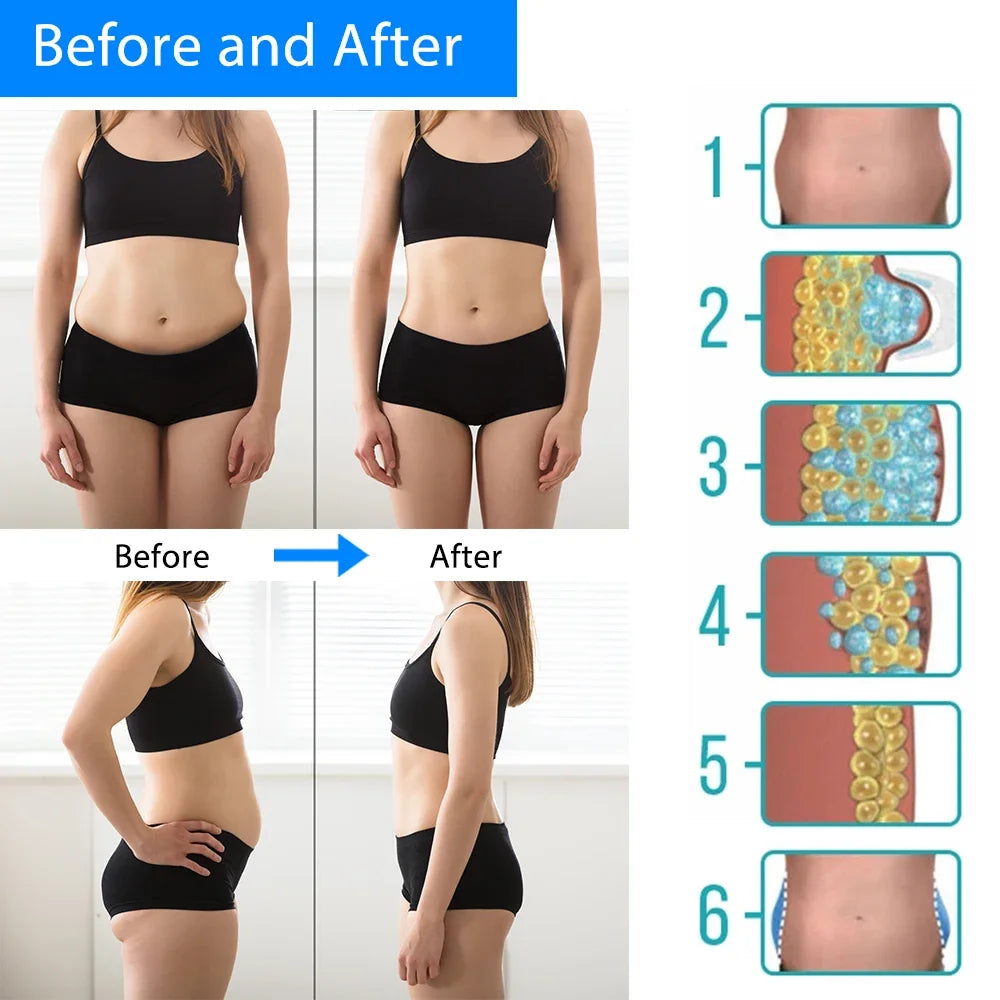 Cryotherapy Fat Freezing Machine | Portable Body Slimming Ivory Massager Body Shaping Massage Equipment Tidesmit