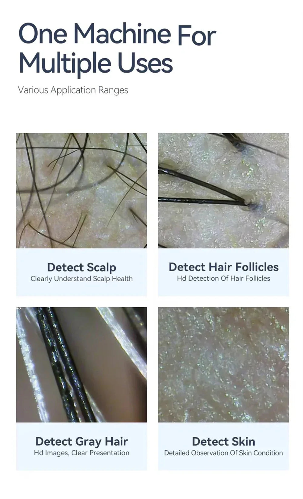 HD digital dermatoscope showing microscopic analysis of scalp, hair follicles, gray hair, and skin health conditions.