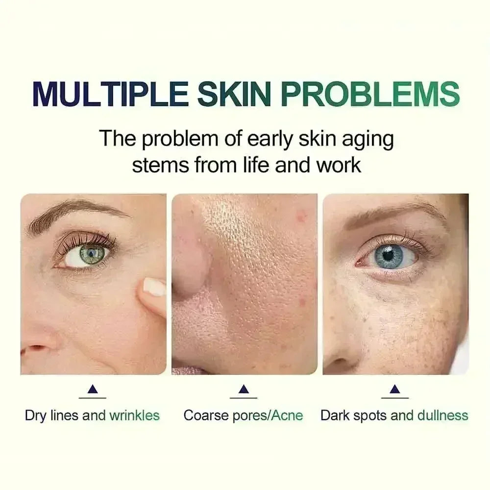 Salicylic Acid Peeling Lotion for Dark Skin | Professional Exfoliation Scrubs Treatments Tidesmit