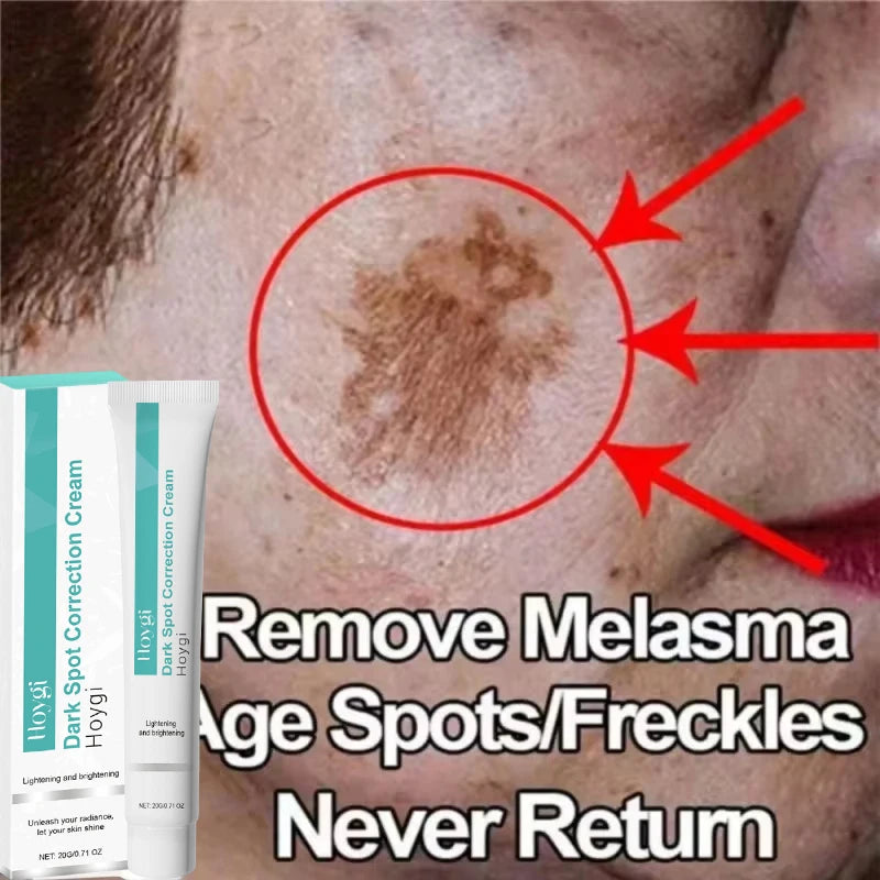 Dark Spot Corrector Cream for Pigmentation & PMU Aftercare | Tidesmit Permanent Makeup Machines Tidesmit