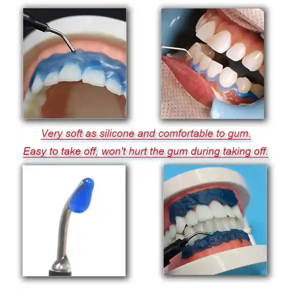 Gingival Barrier Gel for Professional Teeth Whitening - 5PCS Set Lip Care Tidesmit