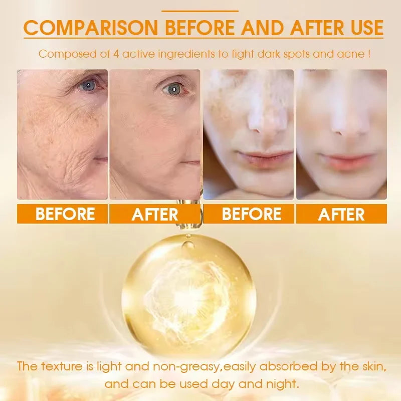 Turmeric Freckle Removing Whitening Essence Fade Pigmentation Melasma Dark Spots Corrector Repair Serum Korean Skin Care
