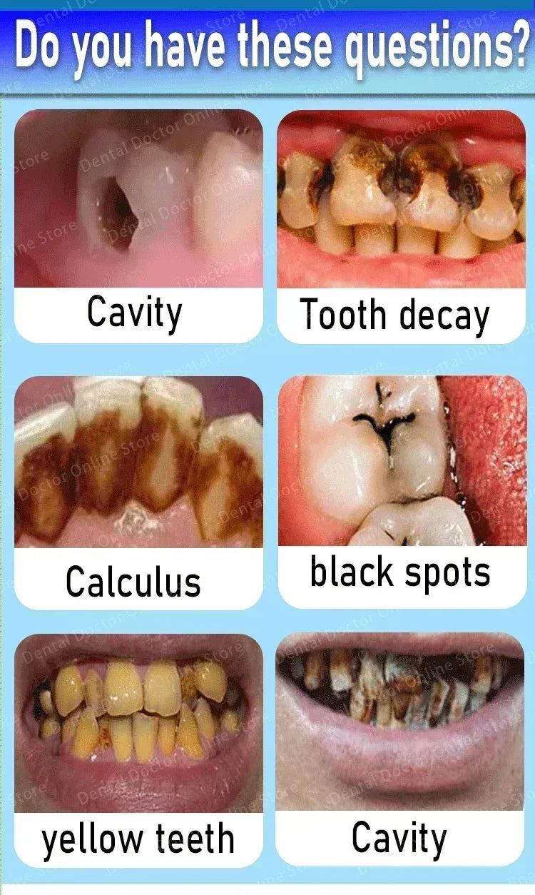 Tidesmit teeth whitening and cavity repair kit for plaque removal and dental enamel protection