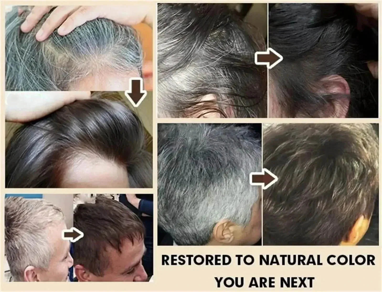 White hair killer, polygonum multiflorum shampoo soap，remove gray hair and restore natural hair color in 7 days