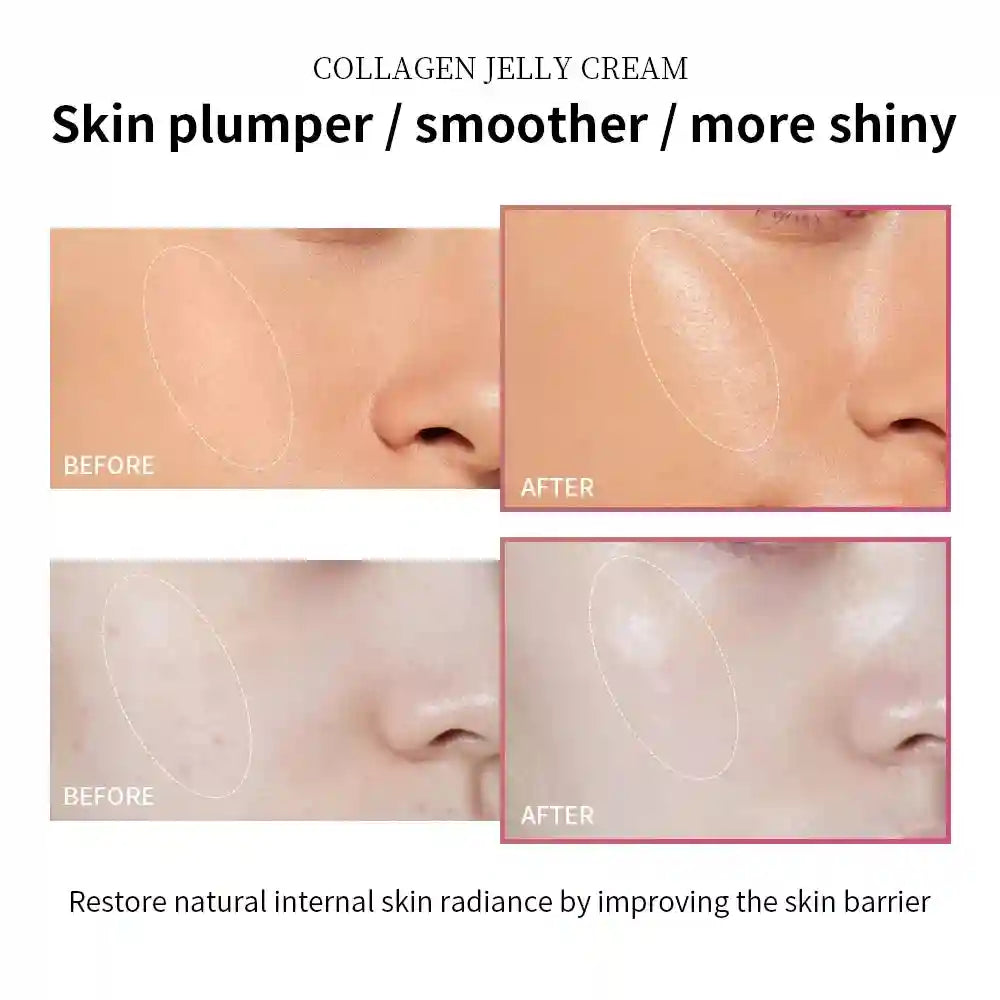 Before and after close-up comparison of skin texture and radiance using Collagen Jelly Cream.