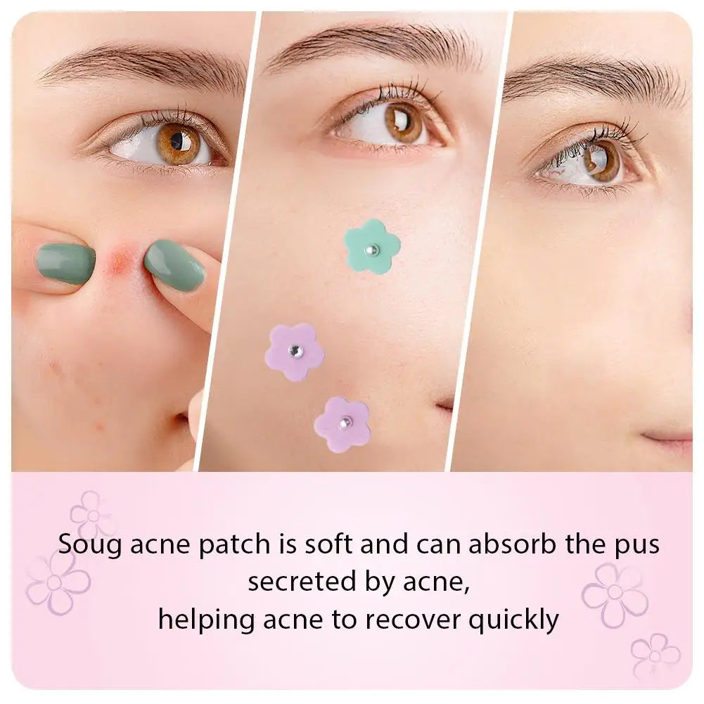 Multicolored Flower-shaped Hydrogel Acne Patch With Pearl/diamond