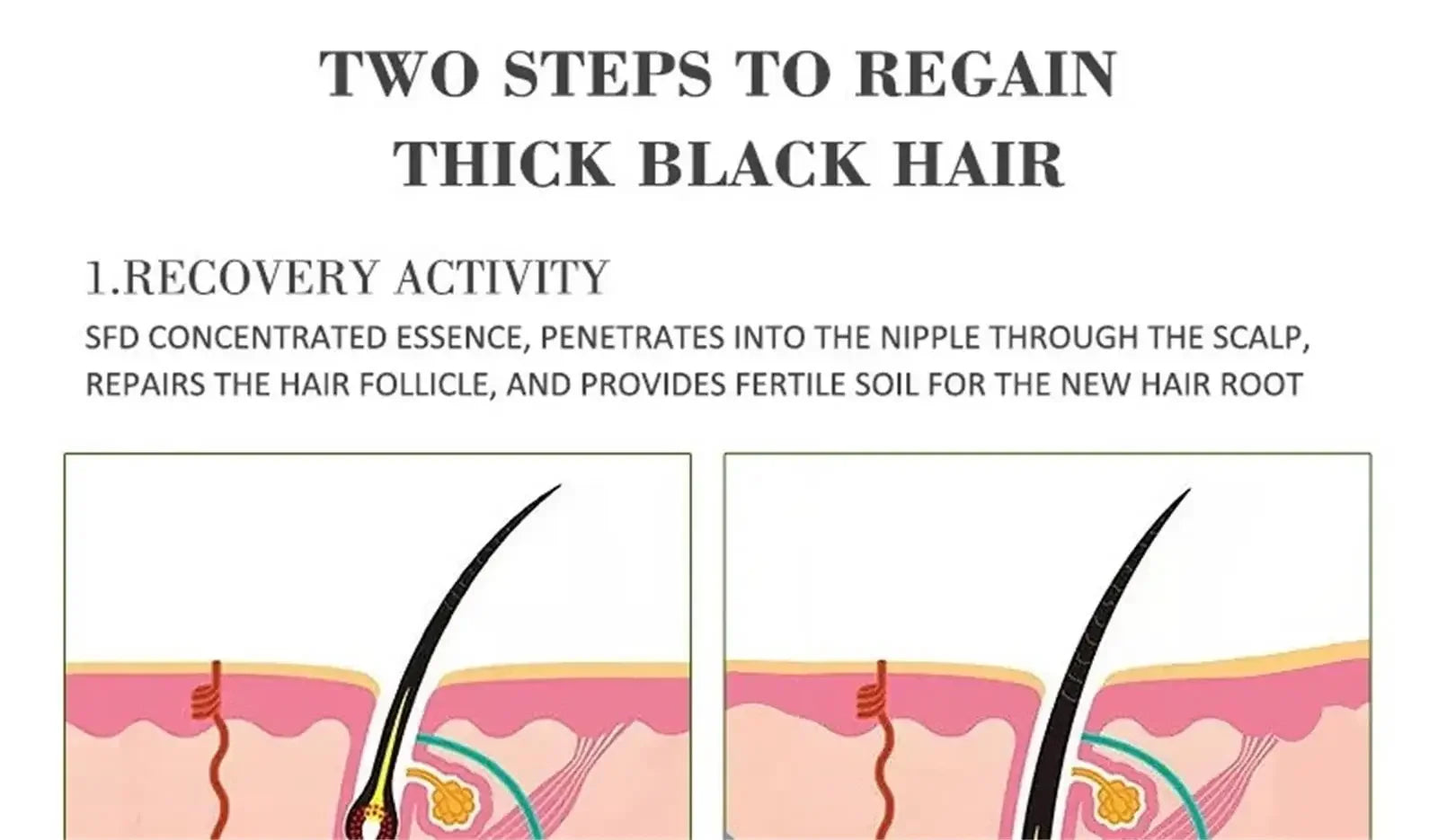 Tidesmit hair growth serum capsule: Fast regrowth, anti-hair loss, follicle repair, and scalp treatment for women.