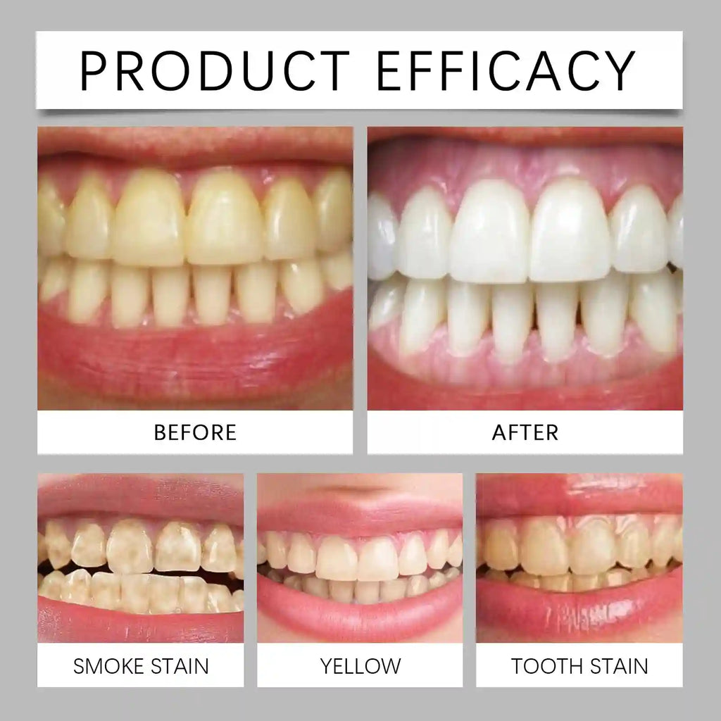 Tidesmit Hydroxyapatite teeth whitening powder for professional stain removal and fresh breath oral care