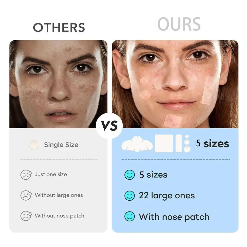 200/262/360pcs Salicylic Acid Acne Patches Mild Non-irritating Fade Black Acne Marks Facial Care Patches Acne Closure Removal