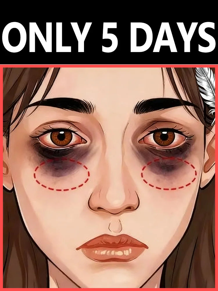 Eye Bag Remover Cream: Professional Depuffing Treatment for Tired Eyes Relaxation Treatment Tidesmit